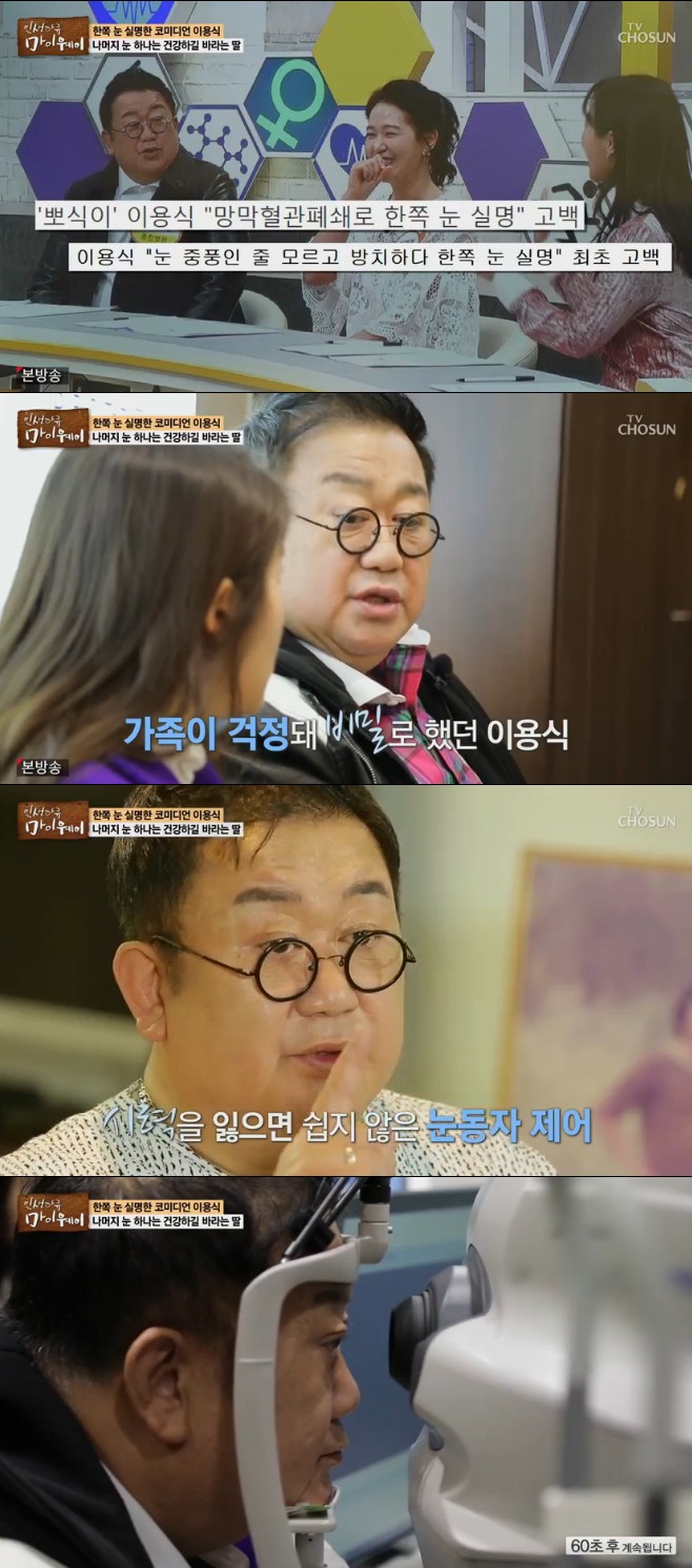 Ƽ���̵��ϸ� ����