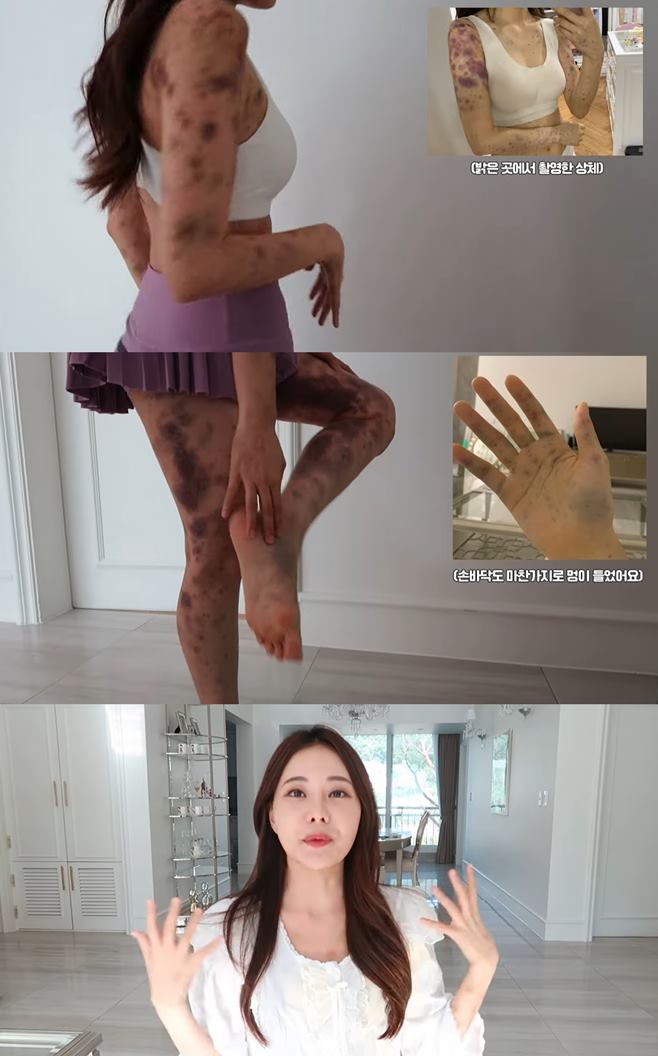 Ƽ���̵��ϸ� ����