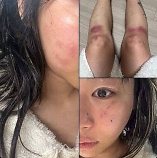 ƼºêÀ̵¥Àϸ® Æ÷Åä