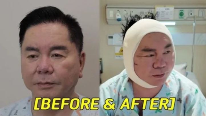 Ƽ���̵��ϸ� ����