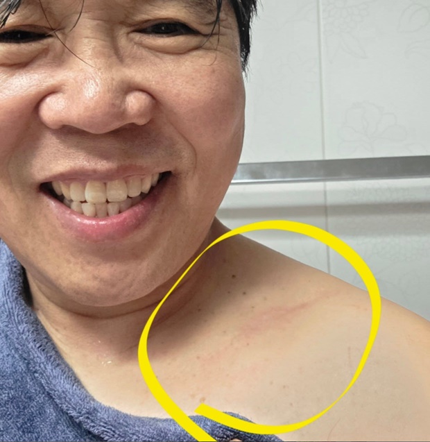 정은표