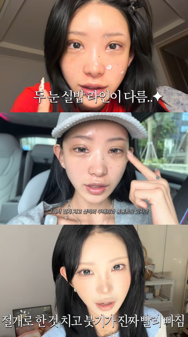최준희